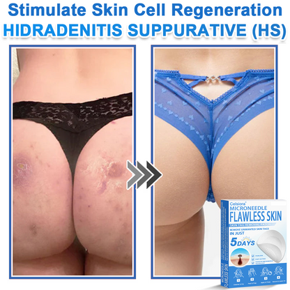 📌Celsiora® 2-in-1 Microneedle & Hydrocolloid Patch | Raised Moles,Acne,  Flat Warts & Skin Tags Remover | Improves Wrinkles, Scars & Blemishes | Invisible Pimple Patches for Face & Body
