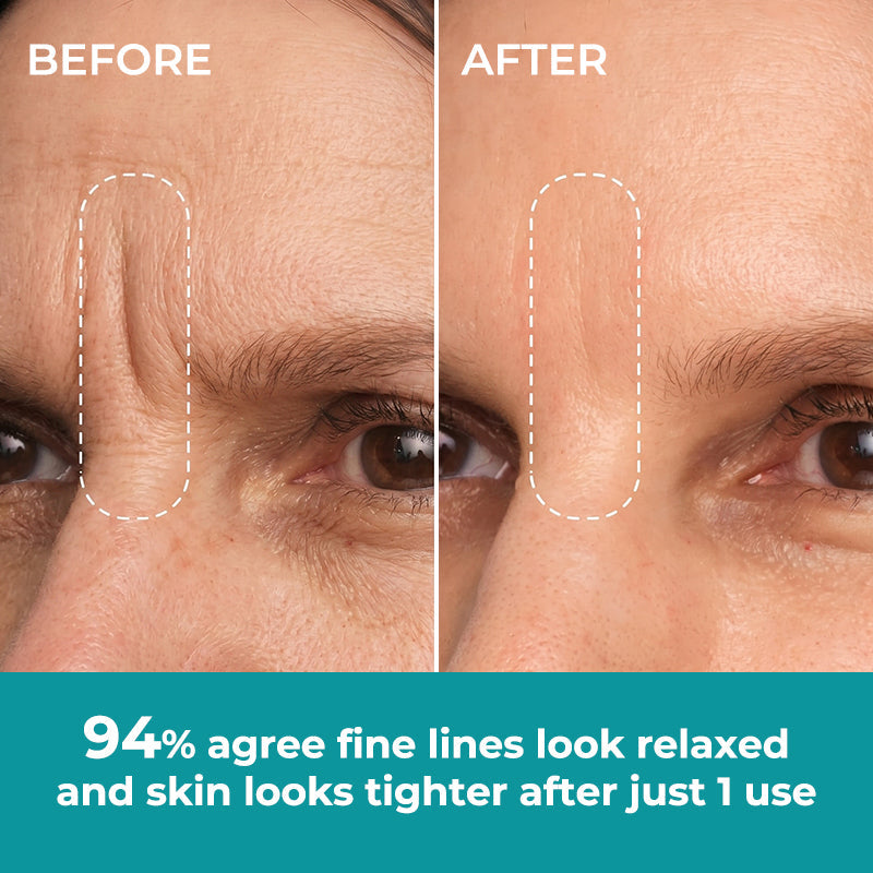 ☀️New 2026 Upgrade🔥 Ivokio® Peptide Face & Eye Tape