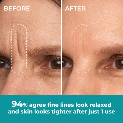 ☀️New 2026 Upgrade🔥 Ivokio® Peptide Face & Eye Tape