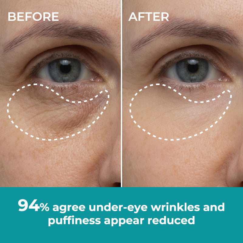 ☀️New 2026 Upgrade🔥 Ivokio® Peptide Face & Eye Tape