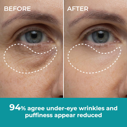 ☀️New 2026 Upgrade🔥 Ivokio® Peptide Face & Eye Tape
