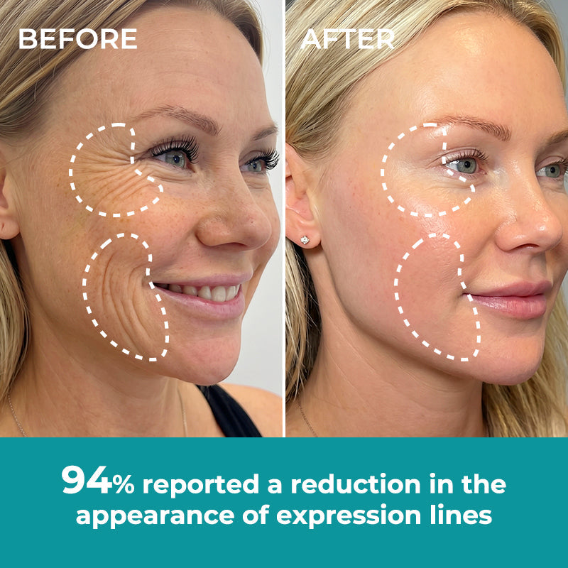 ☀️New 2026 Upgrade🔥 Ivokio® Peptide Face & Eye Tape