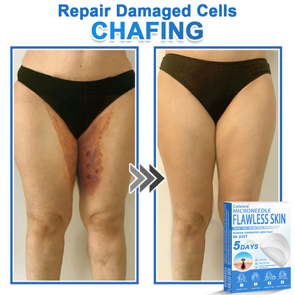 📌Celsiora® 2-in-1 Microneedle & Hydrocolloid Patch | Raised Moles,Acne,  Flat Warts & Skin Tags Remover | Improves Wrinkles, Scars & Blemishes | Invisible Pimple Patches for Face & Body