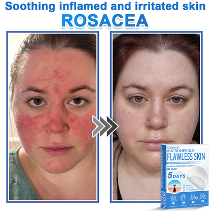 📌Celsiora® 2-in-1 Microneedle & Hydrocolloid Patch | Raised Moles,Acne,  Flat Warts & Skin Tags Remover | Improves Wrinkles, Scars & Blemishes | Invisible Pimple Patches for Face & Body