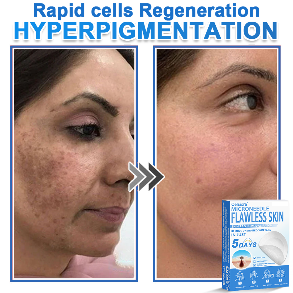 📌Celsiora® 2-in-1 Microneedle & Hydrocolloid Patch | Raised Moles,Acne,  Flat Warts & Skin Tags Remover | Improves Wrinkles, Scars & Blemishes | Invisible Pimple Patches for Face & Body
