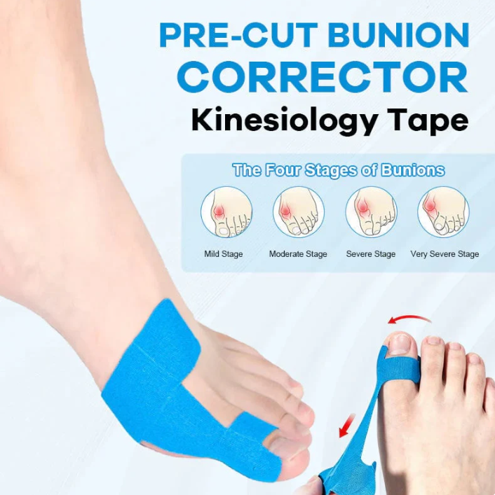 ✨Ivokio® Bunion Relief Toe Correction Wrap