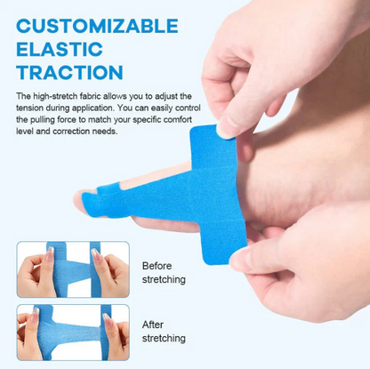 ✨Ivokio® Bunion Relief Toe Correction Wrap