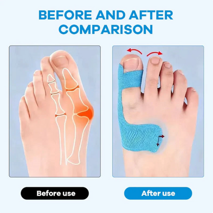 ✨Ivokio® Bunion Relief Toe Correction Wrap